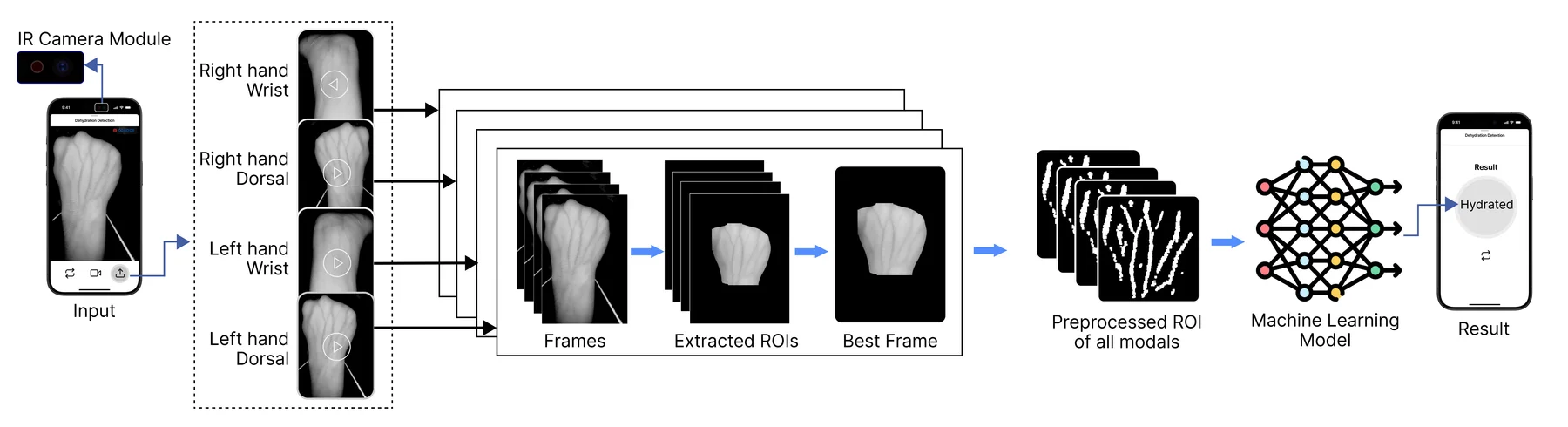 Figure from H2OPulse: Smartphone-Assisted Vein Evaluation for Early Recognition of Dehydration